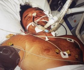 Vincent Todd Tolman in a coma