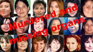 Murdered and Missing Organs